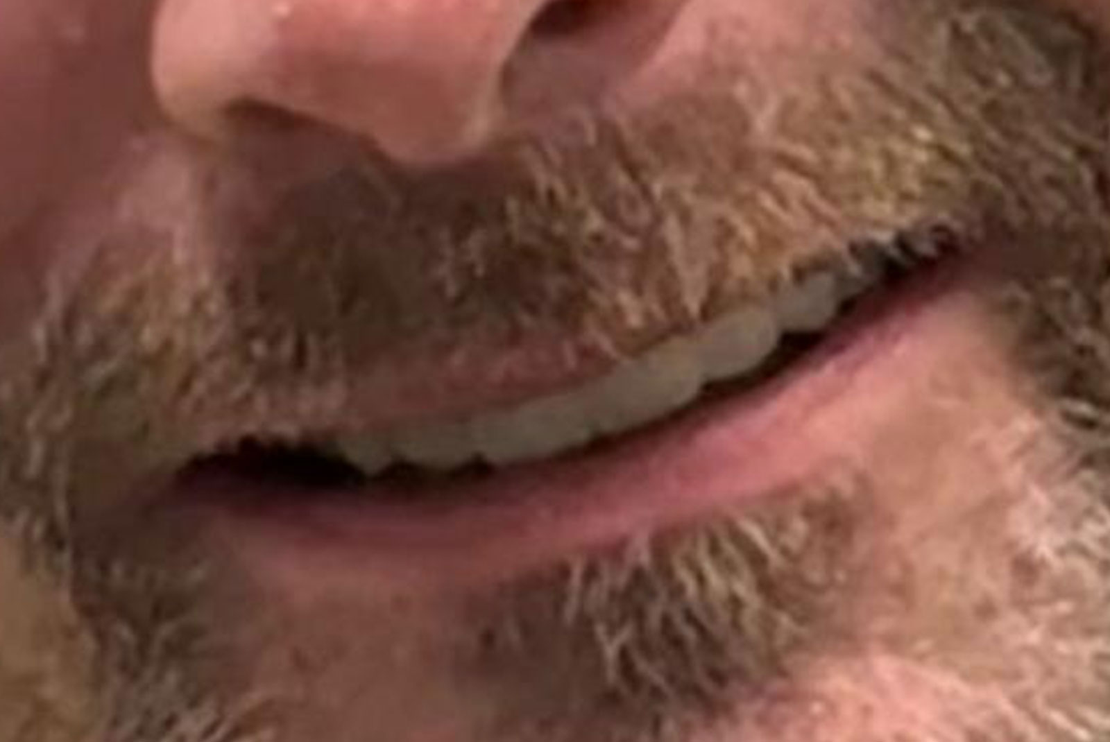 up close before and after dental procedure