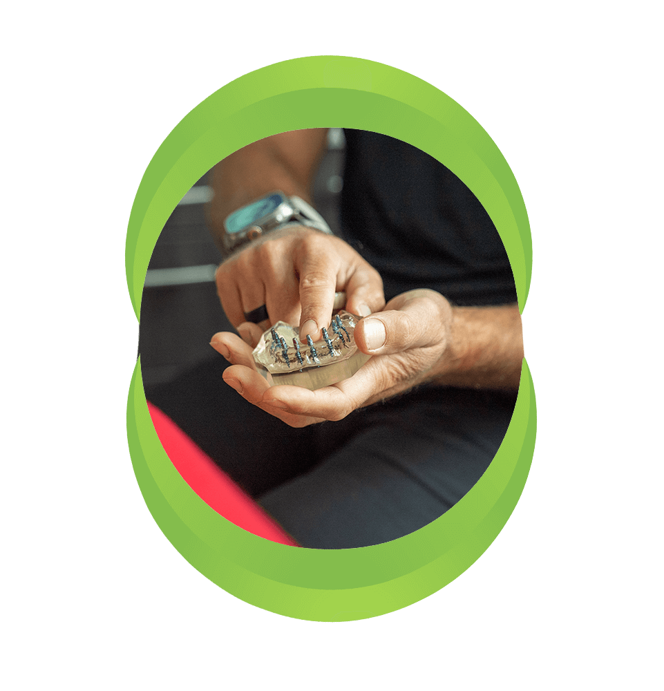 close up of doctor holding up a full arch dental implant