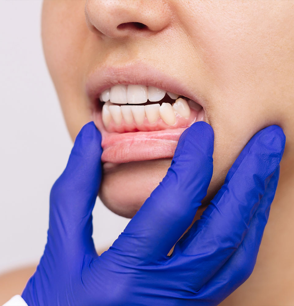 ropped shot of young woman's face with doctor's hand in a blue glove showing healthy gums isolated on a white background